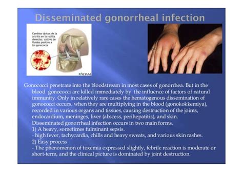 equivocal gonorrhea result|Gonorrhoea .